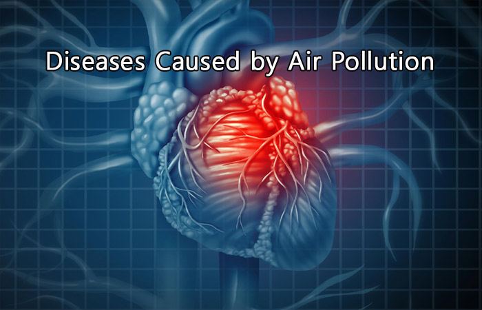 List of 10 Common Diseases Caused by Air Pollution